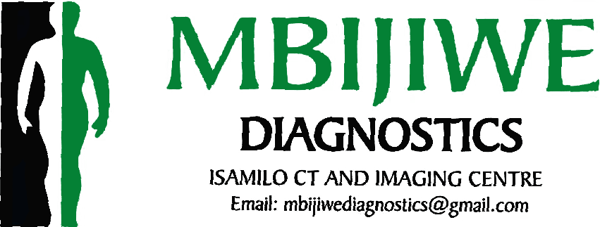 Mbijiwe